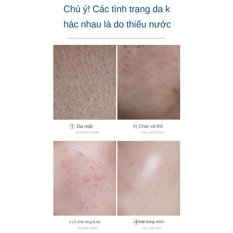 Xịt Khoáng Cấp Ẩm Rellet Ha Moisturizing Spray